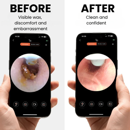 Earpro Vision 2.0